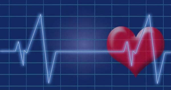 EKG heartbeat
